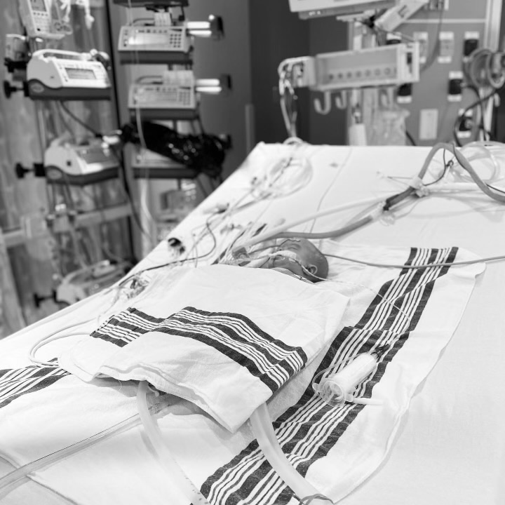 Emmie recovers in the NICU after heart surgery